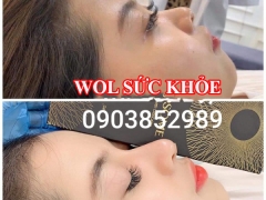 Spa Tiêm Filler Uy Tín Quận 6